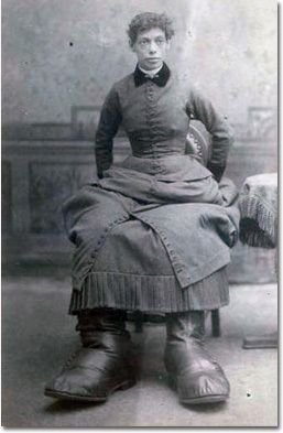 Fanny Mills – “Ohio Big Foot Girl” (image credits: wikimedia)