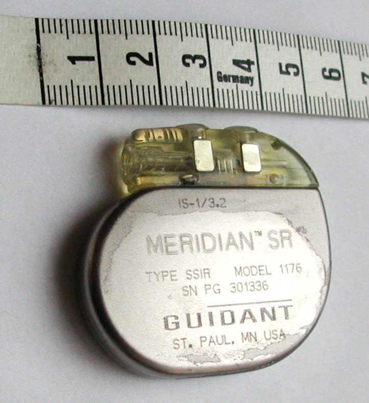Pacemaker (image credits: wikimedia)