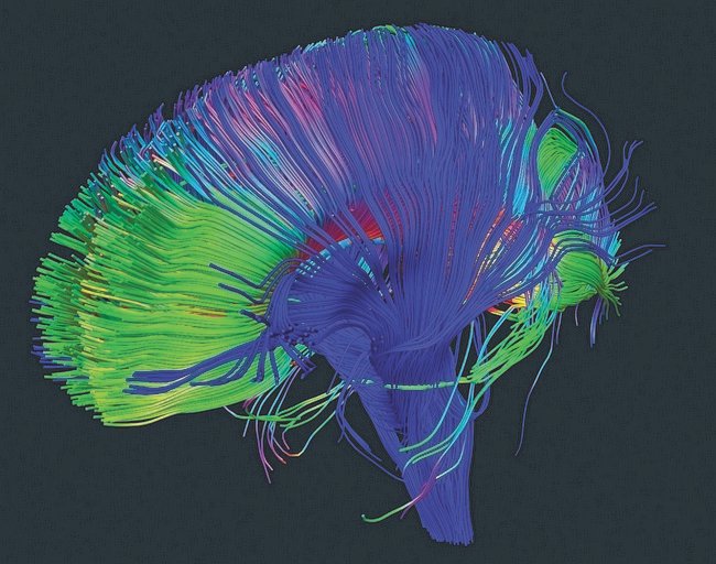 Project Bluebird/Artichoke (image credits: flickr)