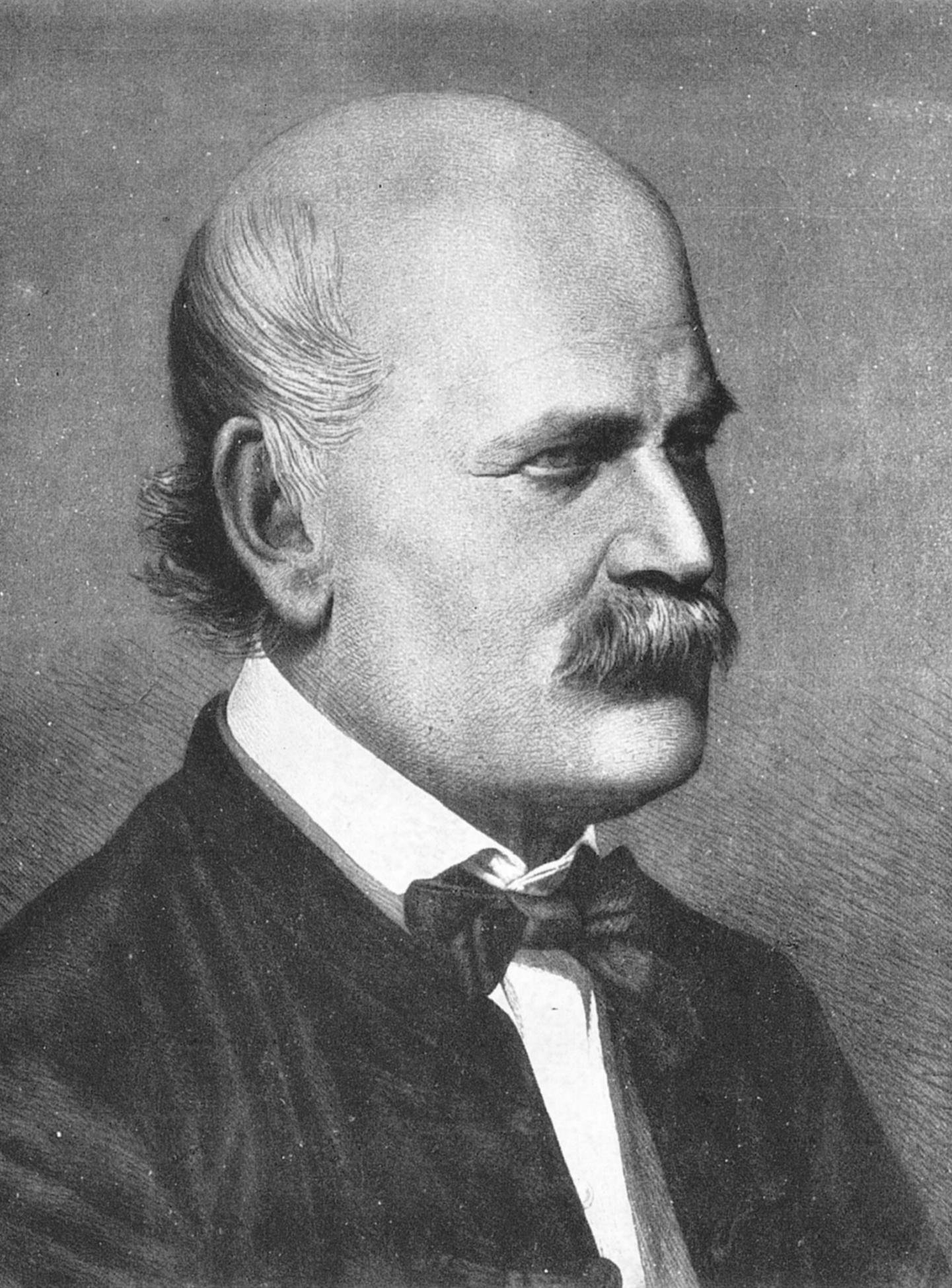 Ignaz Semmelweis: The Doctor Who Saved Mothers with Soap (Benedek, István (1983) Ignaz Phillip Semmelweis 1818-1865, Gyomaendrőd, Hungary: Corvina Kiadó ISBN: 9631314596. plate 15, Public domain)