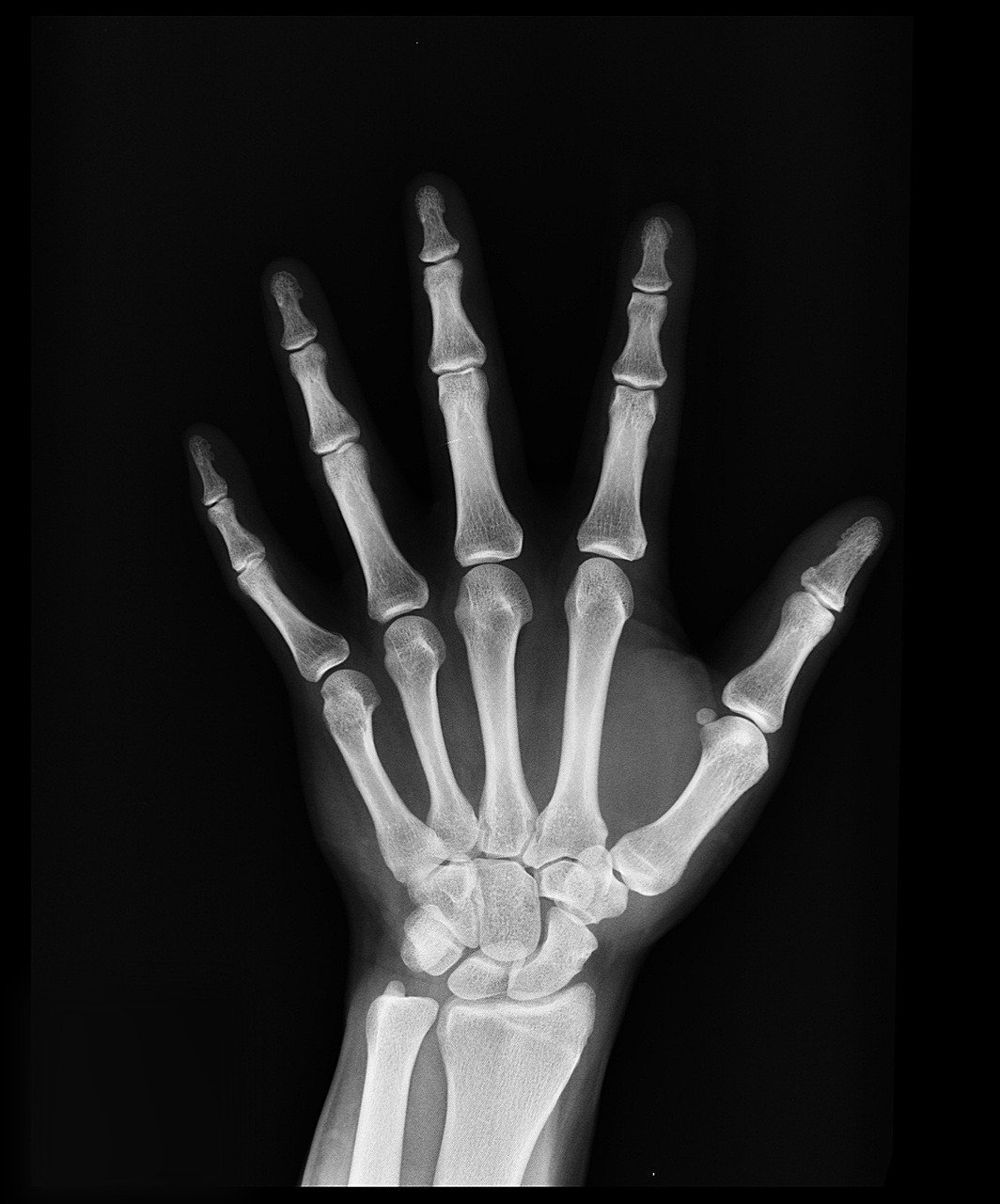 3. X-rays by Wilhelm Röntgen (1895) (Image Credits: Pixabay)