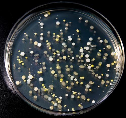 Helicobacter Pylori: Marshall and Warren in 1982 (CdePaz, Flickr, CC BY-SA 2.0)