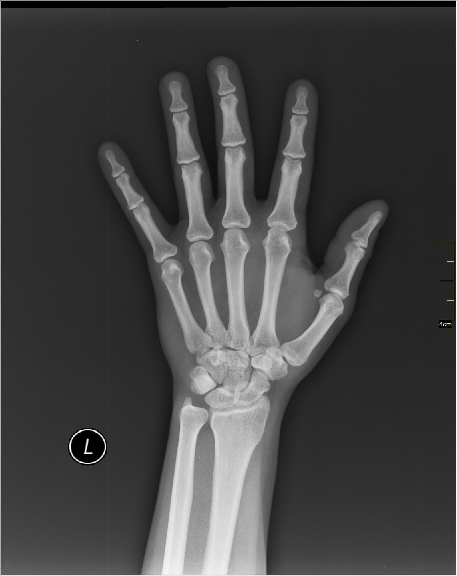 X-rays (By Nevit Dilmen (talk), CC BY-SA 3.0)